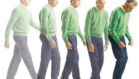 Parkinson